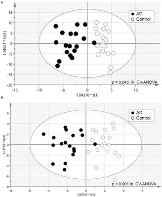 Alterations in Glycerolipid and Fatty Acid Metabolic Pathways in Alzheimer's Disease Identified by Urinary Metabolic Profiling: A Pilot Study